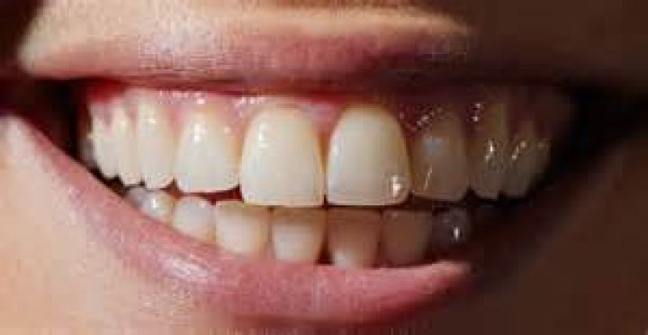 5 Ways You're Staining Your Teeth Without Even Realizing it