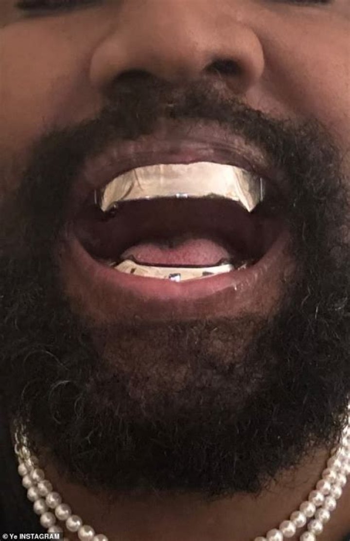 All The 'Major Problems' That Kanye West Might Face After Getting USD 850k Titanium Teeth