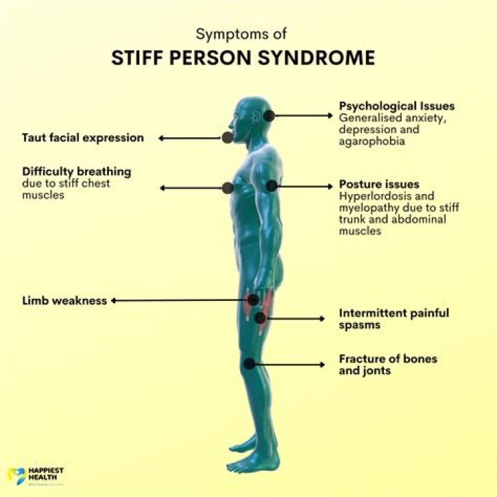Celine Dion diagnosed with stiff-person syndrome: What is it?