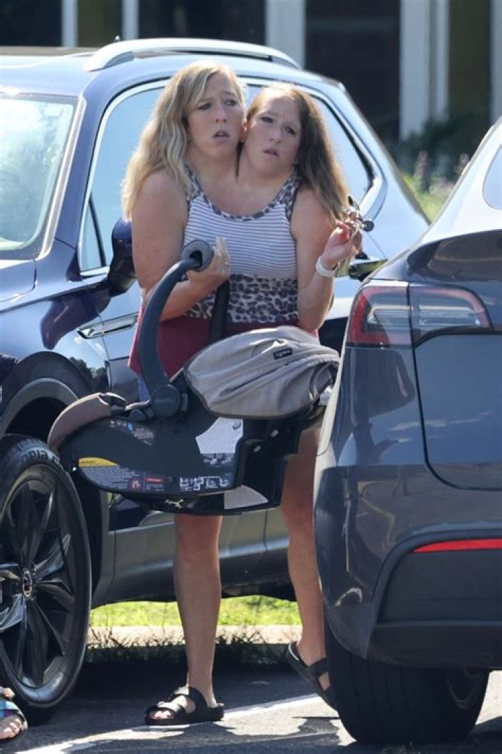 Conjoined Twins Sad News: Abby And Brittany Pregnant