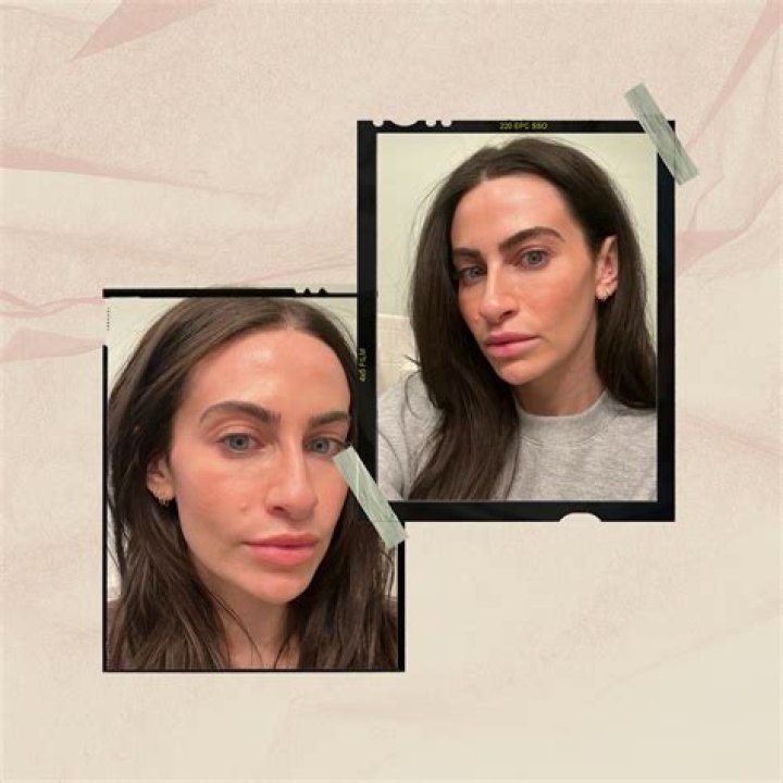 Daxxify Is The Longer-Lasting Botox Alternative You Need To Know