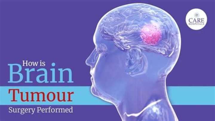Does George Clarke have a brain tumour or neoplasm? Information Regarding The Architect-Television Presenter Health And Illness Update 2022