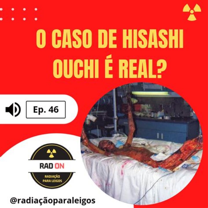 Hisashi Real Photos Day 85: Capturing The Essence Of Everyday Life