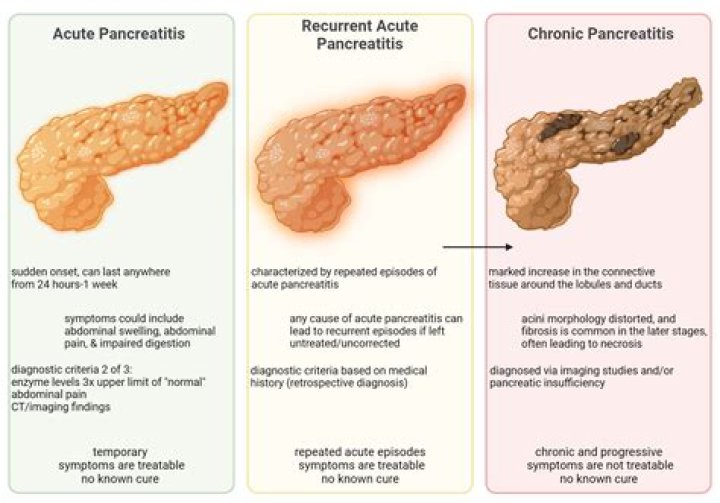 How to differentiate acute pancreatitis from similar conditions