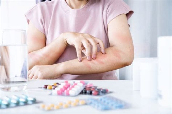 How to treat your allergies without drugs