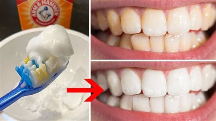 How to whiten teeth without seeing a dentist