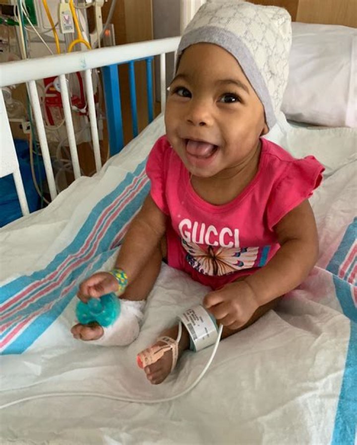 Hydrocephalus: What to know about the condition Alexis Skyy’s daughter Alaiya Grace has
