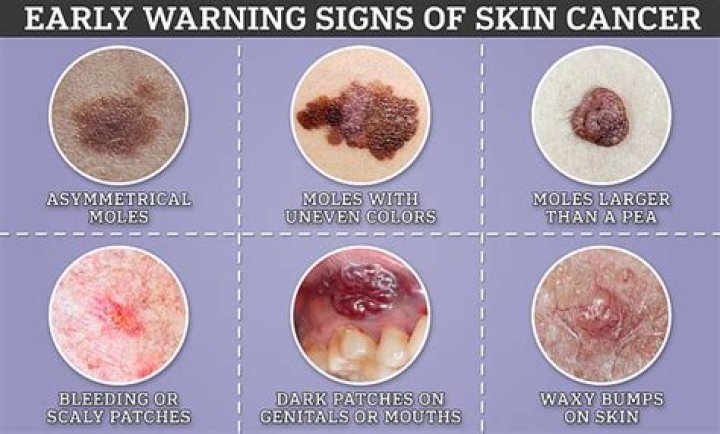 I'm a mum-of-6 & use sunbeds 25 minutes daily - I look 15 years younger, I don't worry about cancer