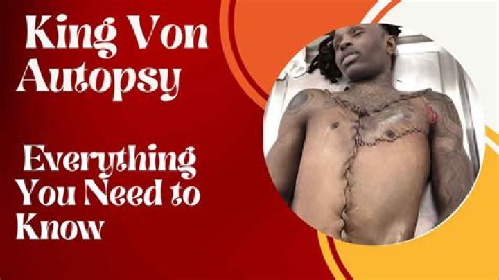 King Von Autopsy Pictures: Understanding The Controversy And Impact