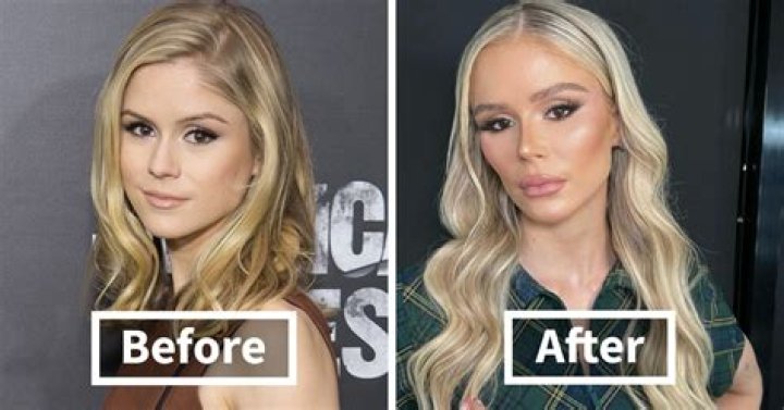 MAFS UK legend Ella Morgan looks unrecognisable before facial surgery as she shares bandaged and bruised throwback snaps