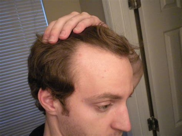 Men’s Haircuts: Best for Receding Hairlines