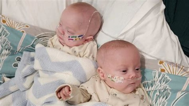 Miracle twins born at just 24 weeks are finally going home after 150 days in hospital