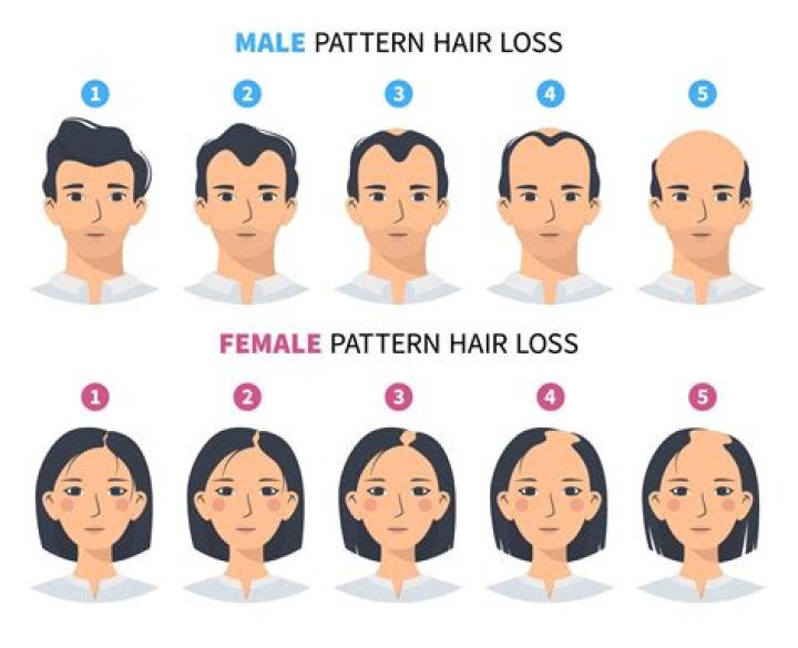 On Baldness As A Black Woman
