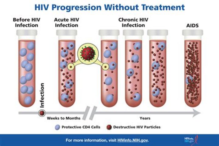 Second HIV-Positive Man May Have Been Cured