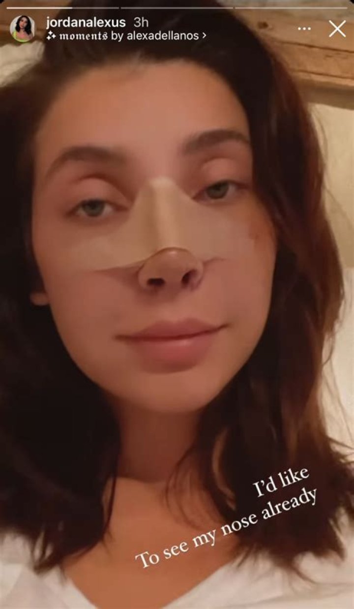 Siesta Key: Jordana Barnes debuts new nose job following criticism from fans