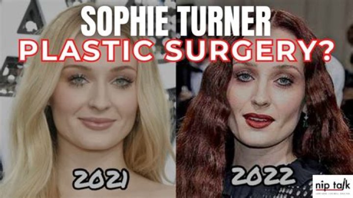 Sophie Rain Before Plastic Surgery: A Comprehensive Look At Her Transformation