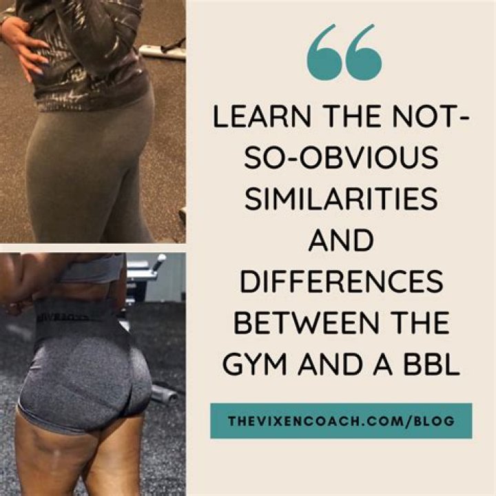 Teen Mom 2 fans mock Briana DeJesus’ Brazilian Butt Lift results
