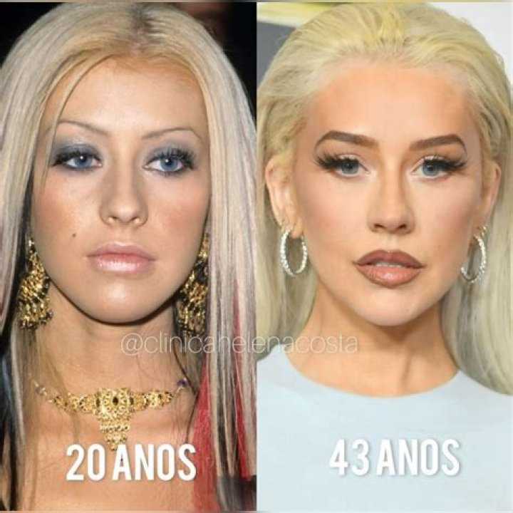 Teen Sensation to Pop Icon: Christina Aguilera's Plastic Surgery