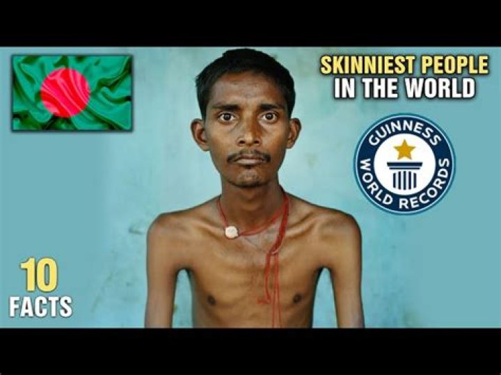The Skinniest People In The World: A Deep Dive Into Extreme Thinness