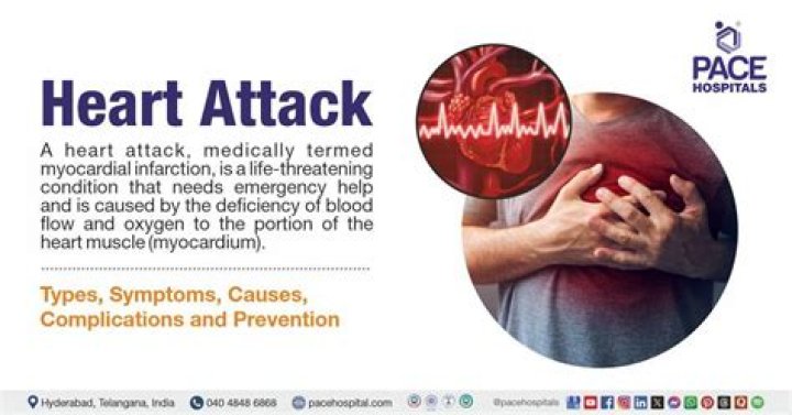 Understanding Jamie Foxx's Heart Attack: Causes, Symptoms, And Recovery