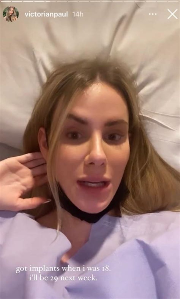Victoria Paul removes breast implant that collapsed after Bachelor in Paradise