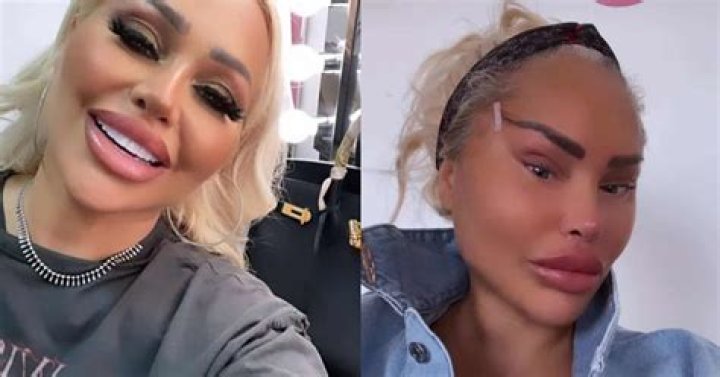 What Happened To Stacey Silva’s Face? A Candid Look at Plastic Surgery
