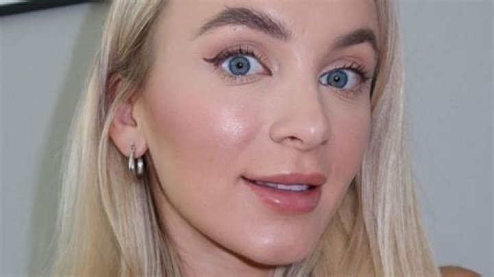 Yara Zaya shares details on her plastic surgeries and cosmetic procedures: ‘No regrets’